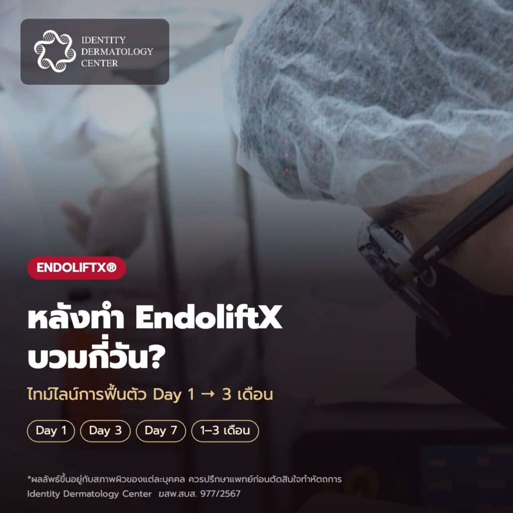 หลังทำ EndoliftX บวมกี่วัน ไทม์ไลน์การฟื้นตัว