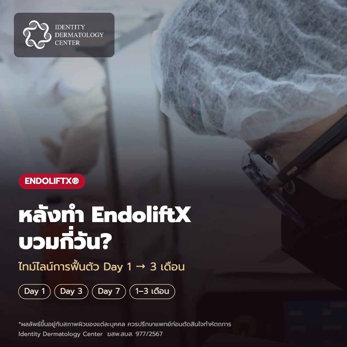 หลังทำ EndoliftX บวมกี่วัน? ไทม์ไลน์การฟื้นตัวตั้งแต่ Day 1 ถึง 3 เดือน