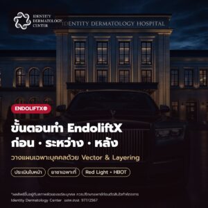 ขั้นตอนทำ EndoliftX ที่ Identity ก่อน ระหว่าง หลังทำ
